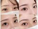ルーカス(Lucas)の写真