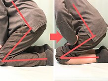 杉本接骨鍼灸院/膝の症状例：施術を受けた方の声