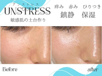 ビバディ(Vivady)/UNSTRESS