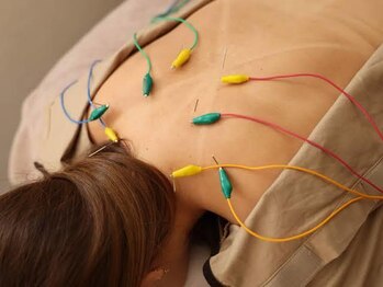 ひだまり鍼灸整骨院/電機はり施術