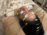 【人気NO5】目元もスッキリ☆電気を流す美容鍼　¥8,800