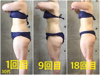 ペリー(PELLY)/女性30代 before after