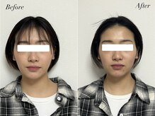 パール(Pearl)/フェイス＆ドライヘッドスパ