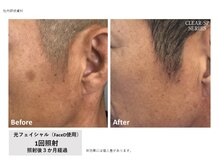 シズク ビューティーサロン(SHIZUKU beauty salon )/