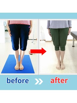 ストレッチヒーロー 鳥取店(STRETCH HERO)/O脚/X脚