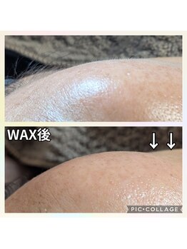 ウィズユー(with U)/フェイシャルWAX