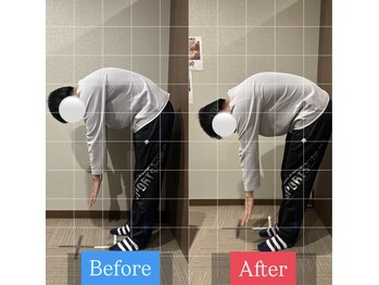 ナオル整体 宮崎院(NAORU整体)/20代男性施術事例【腰痛改善】