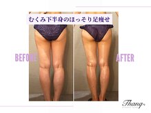 サンク(Thanq)/下半身太り・むくみ太り