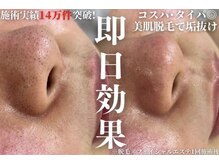 アルゴ 福井店(ALGO)の雰囲気（脱毛×フェイシャルエステで肌質改善♪）