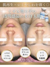 ソユ(SOYOU)/施術* &nbsp;&nbsp;&nbsp;&nbsp;&nbsp;&nbsp;&nbsp;ダクトピール