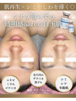 ソユ(SOYOU)/施術* &nbsp;&nbsp;&nbsp;&nbsp;&nbsp;&nbsp;&nbsp;ダクトピール