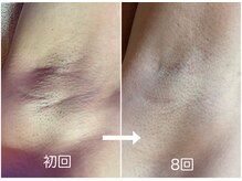 カミーシャ(KaMi-Sha)/超快適～♪のお声いただきました