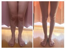 美容整体カラダリメイク(karada)/骨盤矯正ダイエットの結果