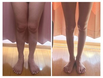 美容整体カラダリメイク(karada)/骨盤矯正ダイエットの結果