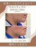 【たるみ・小顔】ヒト幹細胞導入フェイシャル16500円→5500円