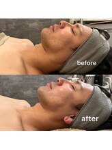 キノ(Kino)/レモンボトル