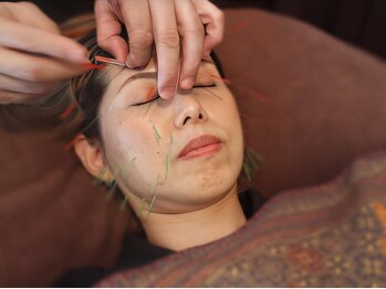 三国ヶ丘鍼灸整骨院/三国ケ丘産後整体/美容鍼灸