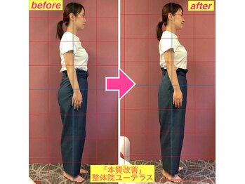 ユーテラス/産後ケアでウェスト12センチ減！