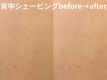 ももとゆでたまご/ドレス映え背中肌シェービング