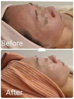 サロン ド ハニー(Salon de Honey)/