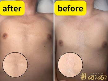 サロンビビ 町田店(Salon BiBi)/胸やお腹の毛は意外と強い