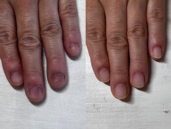 ヴェールリム(verl lim)/