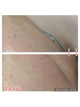 ウィズユー(with U)/フェイスWAX