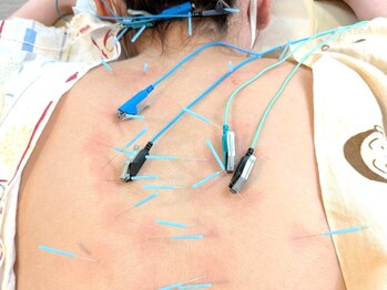 シープ(Sheep)の写真/≪首肩・腰の辛さに直接アプローチ≫歴17年の国家資格所持者による本格施術◎『効く~!!』と話題の鍼灸☆