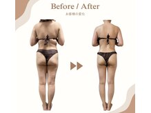 ビループ(biloop)