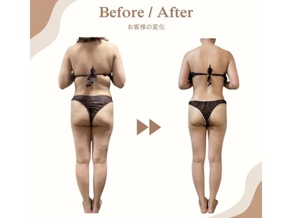 ビループ(biloop)の写真