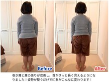 ラシュシュ/ビフォーアフター