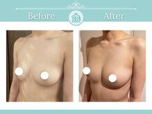 美人バスト 表参道店の雰囲気(育乳プロが育ちづらい原因を徹底解明!バストアップは夢じゃない)