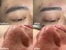 【眉毛Wax + 毛穴洗浄】顔全体の印象が変わるメンズケア