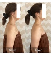 トリムリターン 三重伊賀店Mana/姿勢が整えば、顔もリフトアップ