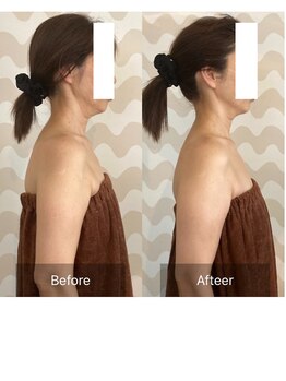 トリムリターン 三重伊賀店Mana/姿勢が整えば、顔もリフトアップ