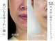 アリビオ(alivio)の写真