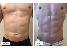 エイシスグロウ(asis glow.)/効果写真