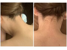 アヴィジョン(Avision)/