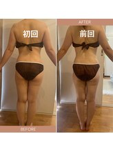 エイミー 藤ヶ丘店(Amy)/before→after