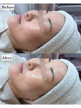 ソワナ(soina)/【神楽坂駅/フェイシャル/毛穴】