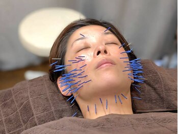 カンワ美容鍼灸院(KANWA美容鍼灸院)の写真/小顔矯正+美容鍼に不純物を流すマッサージでムクミ解消!鍼の前にマッサージをするのでお肌の負担が最小限