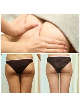 フラフィ 宇都宮本店(fluffy)/脂肪を撃退！下半身スッキリ♪