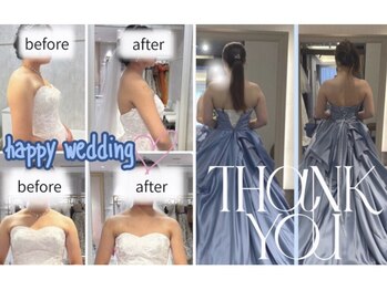 ティースタイル(T-Style)/before/after