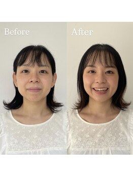 パーソナルサンフラワー(PersonalSunflower)/お客様ヘアメイク Before/After