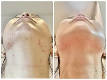 ポモナ 横浜馬車道店(Pomona)の雰囲気（オーナー自信が当店の施術のみでこんなに綺麗に！証拠、根拠あり）