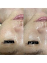 トータルビューティーサロンリア(Li'a)/【30代前半】新メニュー