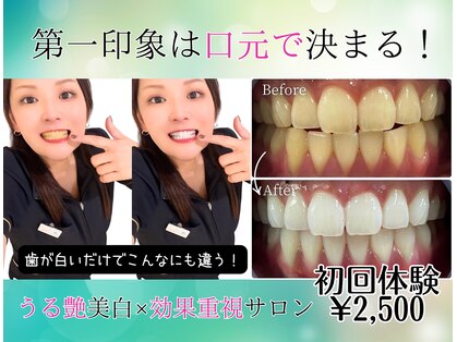 ホワイトニングショップ 多摩店の写真