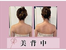 風薫(フウカ)/美背中│ビフォーアフター