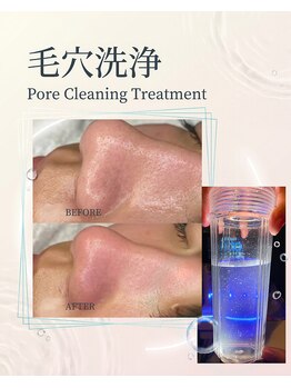 大足スパ 両国 錦糸町(BIG FOOT SPA)の写真/両国駅30秒｜錦糸町｜浅草橋ハイドロ毛穴洗浄で角栓・皮脂汚れをオフ！完全個室フェイシャルでつるん素肌へ