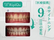 リピカ(RipiQa)/施術例